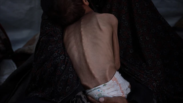 Gazze’de açlıktan ölenlerin sayısı 455’e yükseldi