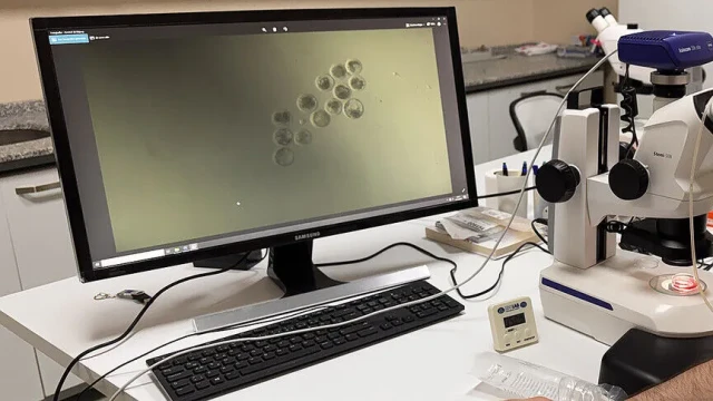 "Beta-laktoglobulin" süt proteini ihracat şartıyla üretilebilecek